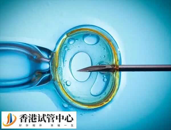 香港做试管婴儿也需要满足适应症