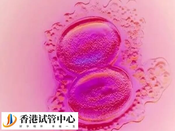 子宫内膜异位会影响胚胎着床