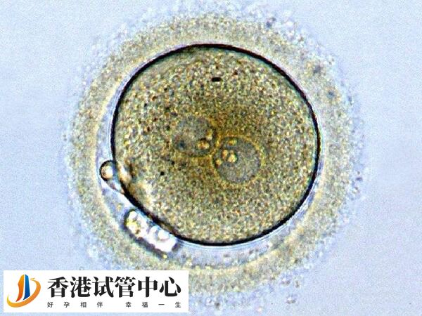 胚胎发育潜力差会引起生化妊娠