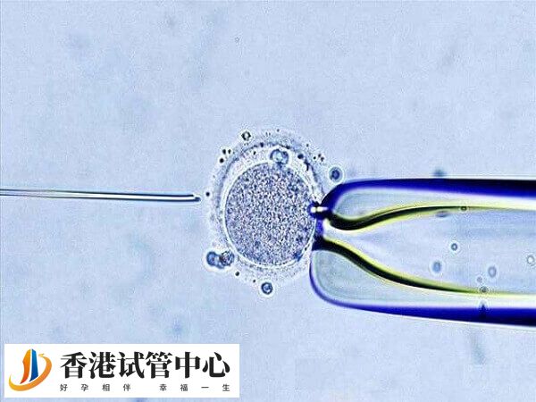 囊胚移植3天成功的征兆